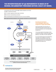 IgA nephropathy mechanism of disease (MOD) diagram.