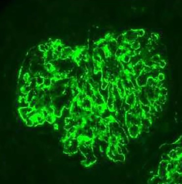 C3G Immunofluorescence